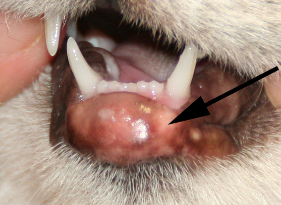 Een verschijningsvorm van het eosinofiel granuloom.