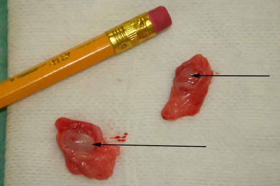 Dierenkliniek Tiel-Drumpt: Het steriliseren van een poes. De eierstokken zijn erg klein.