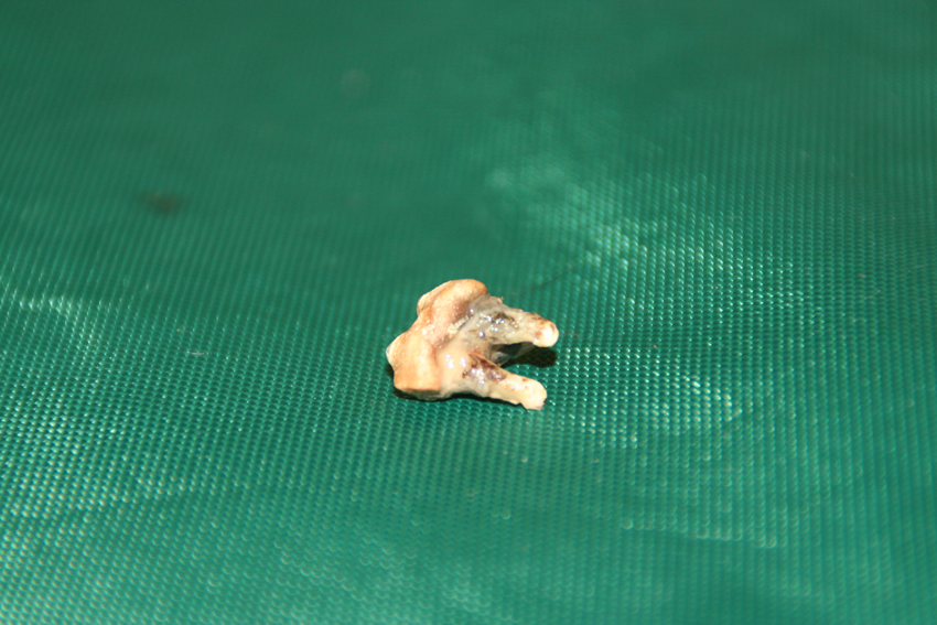 afbeelding Februari 2013 gebitsmaand