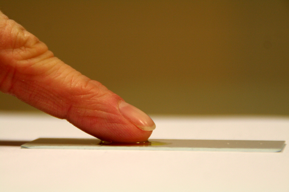 Dierenkliniek Tiel-Drumpt: Het klassieke "FIP" vocht is draden trekkend. Helaas is dat niet altijd even duidelijk.