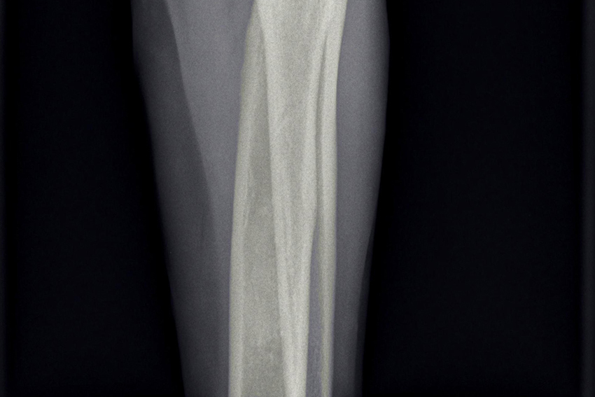 afbeelding Enostose bij de hond