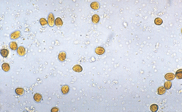 Dierenkliniek Tiel-Drumpt: De dierenarts kan met behulp van ontlasting, van het liefst 3 aansluitende dagen, giardia aantonen.