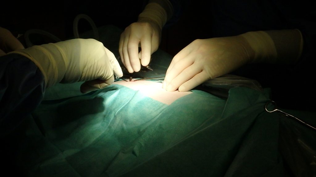 Dierenkliniek Tiel-Drumpt: Laparoscopische sterilisatie bij de hond: De veresnaald is geplaatst en daarna gaat de eerste trocar geplaatst worden.