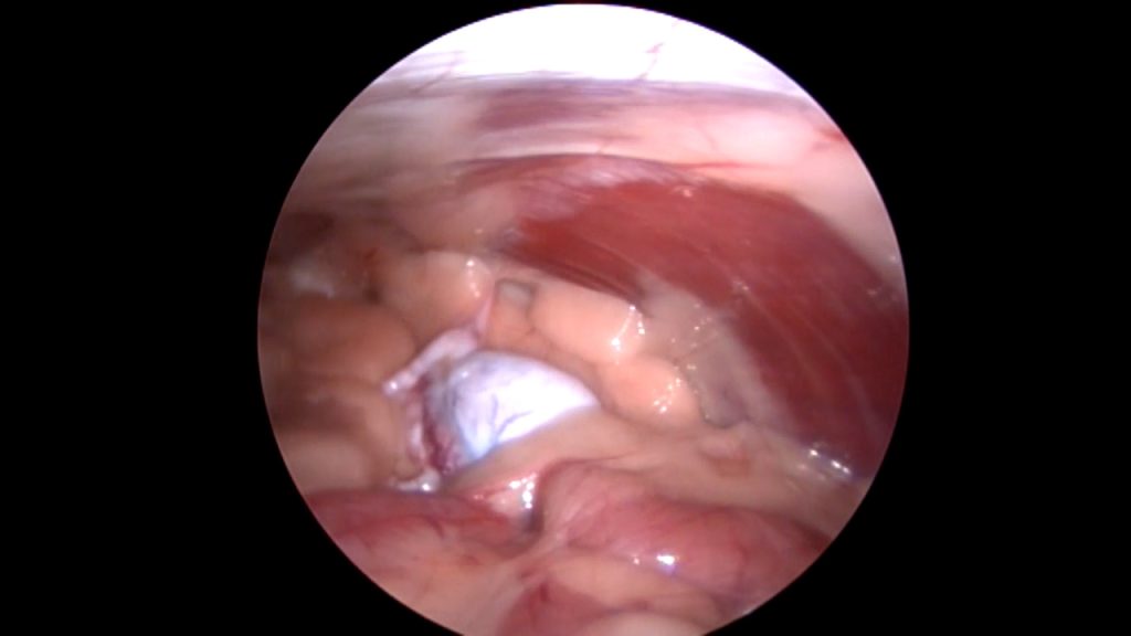 Dierenkliniek Tiel-Drumpt: Laparoscopisch geassisteerd opereren; Met de camera brengen we de testikel in beeld.