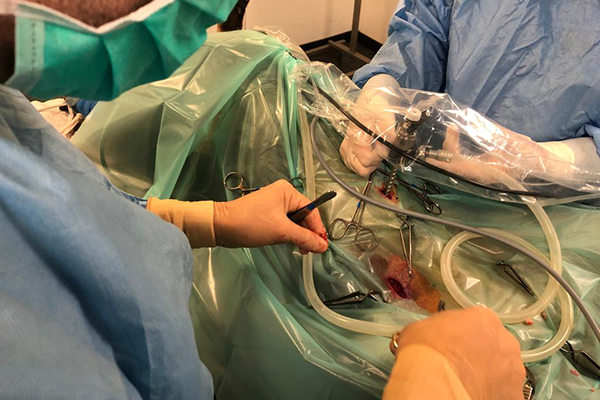 afbeelding Laparoscopisch geassisteerd opereren