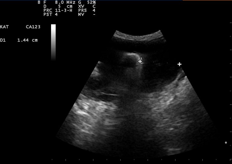 afbeelding Beeldvorming