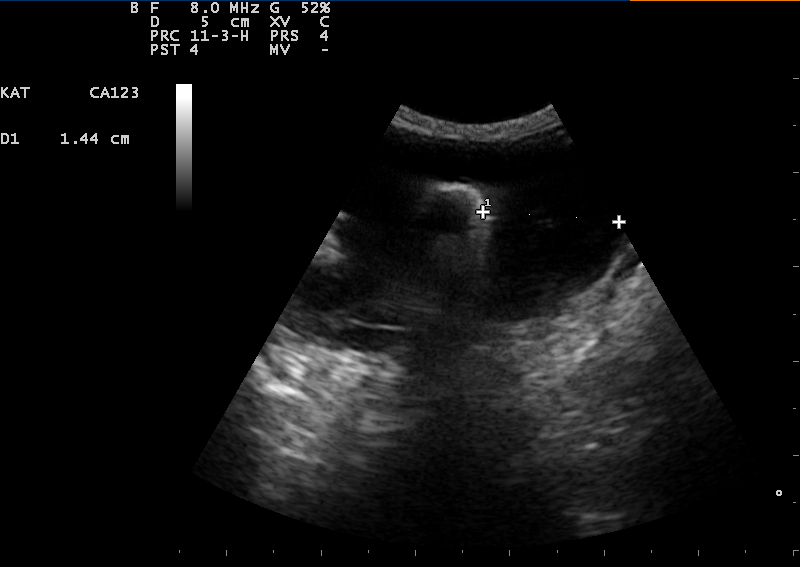 afbeelding Beeldvorming