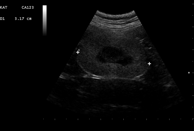 Dierenkliniek Tiel-Drumpt: Nierprobleem: echo beeld van een afwijkende nier