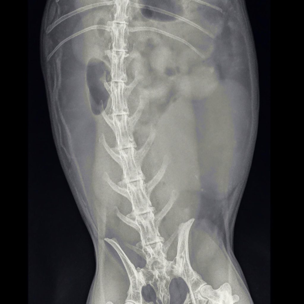 afbeelding Baarmoederkanker