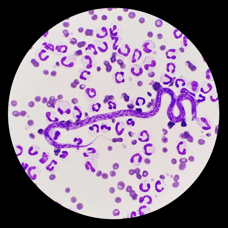 afbeelding Buitenlandse parasieten