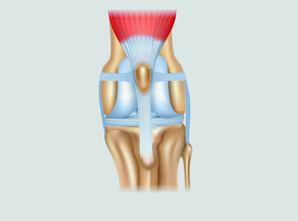 Dierenkliniek Tiel-Drumpt: Patellaluxatie