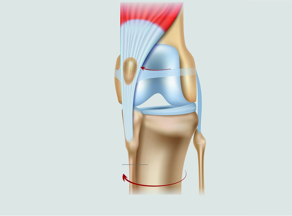 Dierenkliniek Tiel-Drumpt: Patellaluxatie